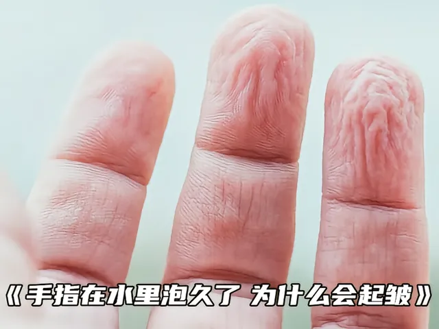 为什么手指在水里泡久了会起皱？并不是常说的渗透作用...