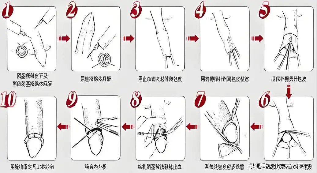 包皮粘连解决方法 蜜獾奇葩交配方式揭秘