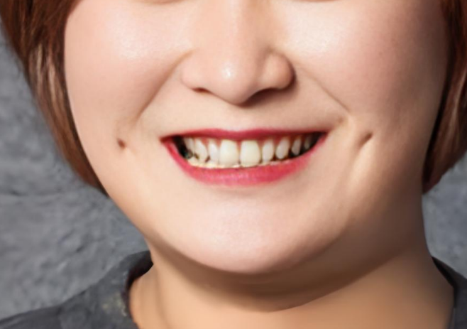 夫妻双方都没有酒窝,而女儿却有酒窝,这种情况正常吗...
