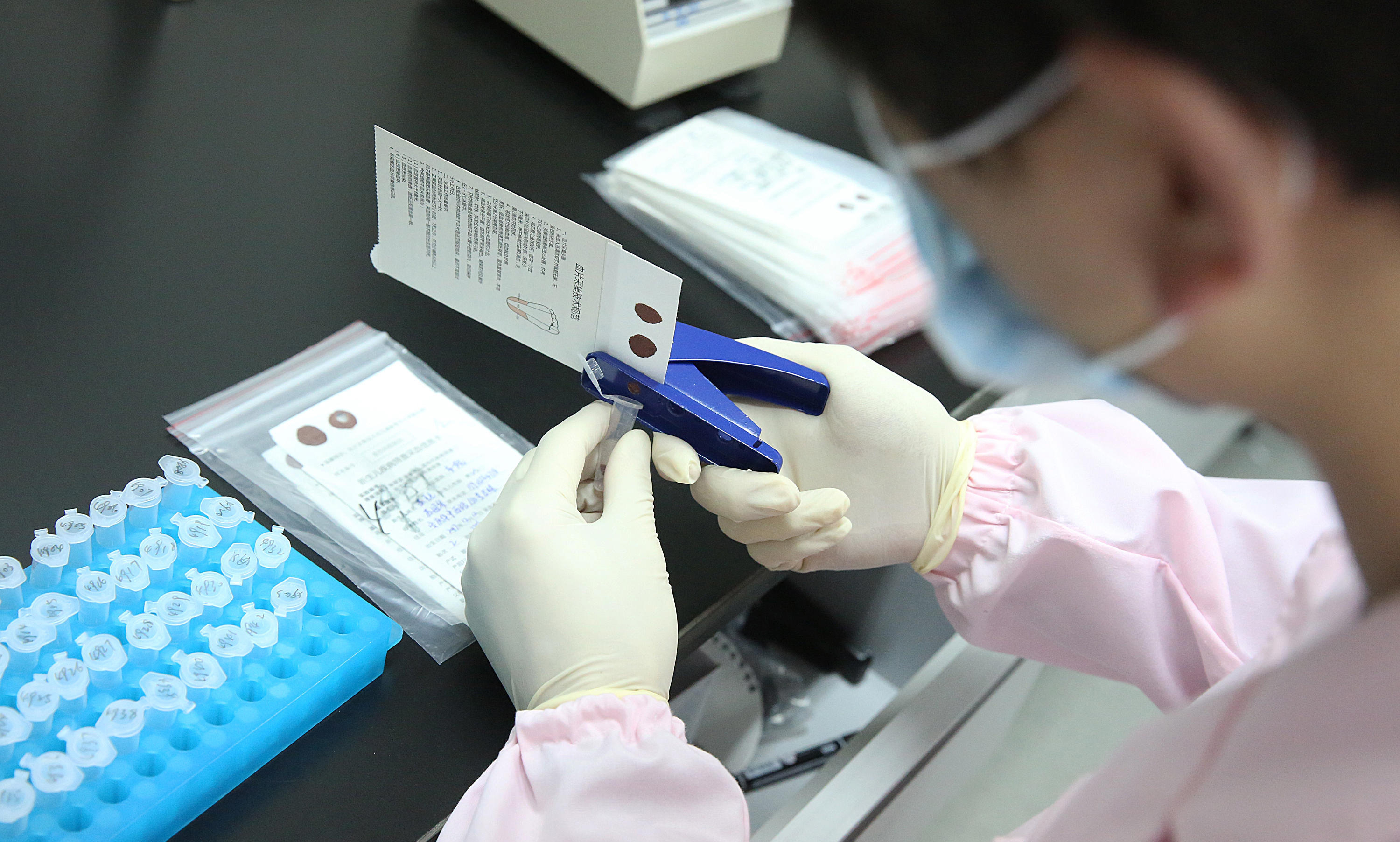 基因检测能做什么 肺癌患者为什么要做基因检测
