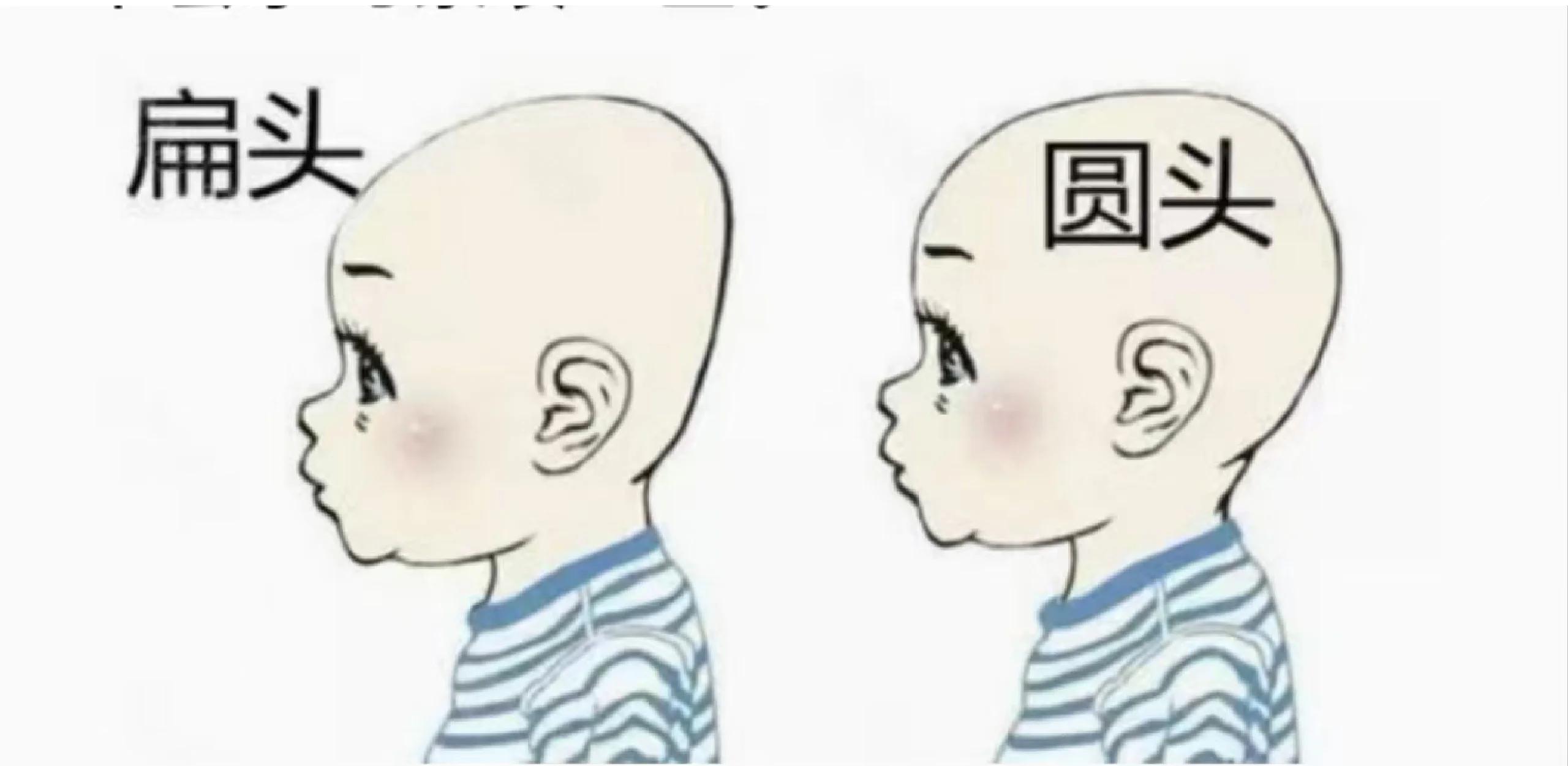 孩子睡扁头真的会影响智力和福气吗？揭秘真相！