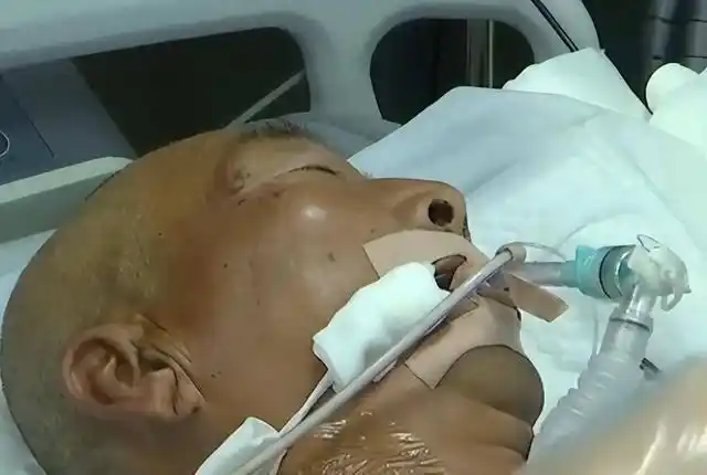 人身上这7个器官未来可能会消失，看下哪个是你讨厌的...