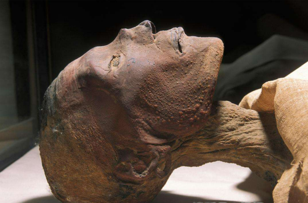 唯一被人类消灭的病毒，还保存在实验室，为什么不将其...